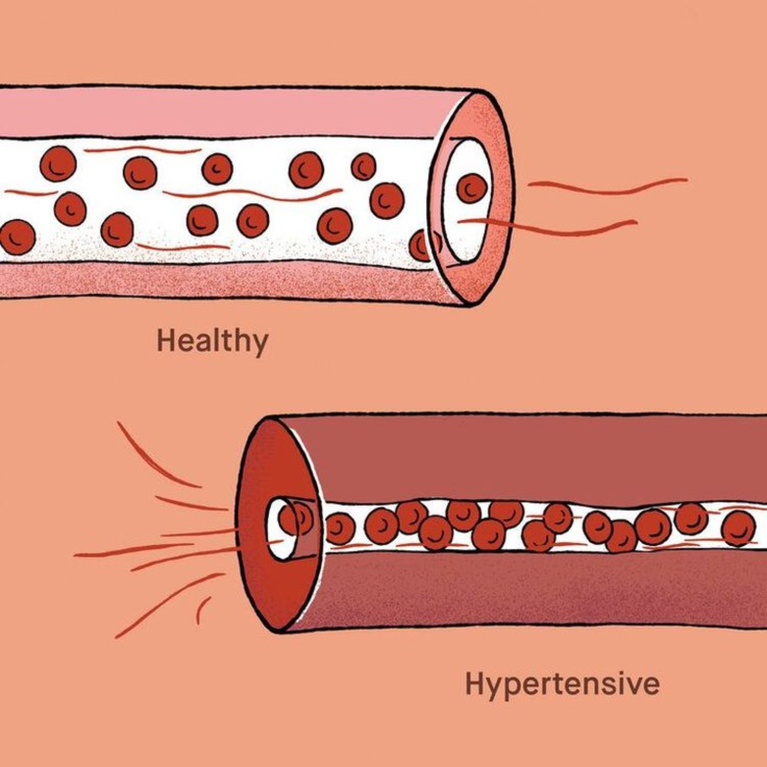Diabetes and Blood Sugar Management