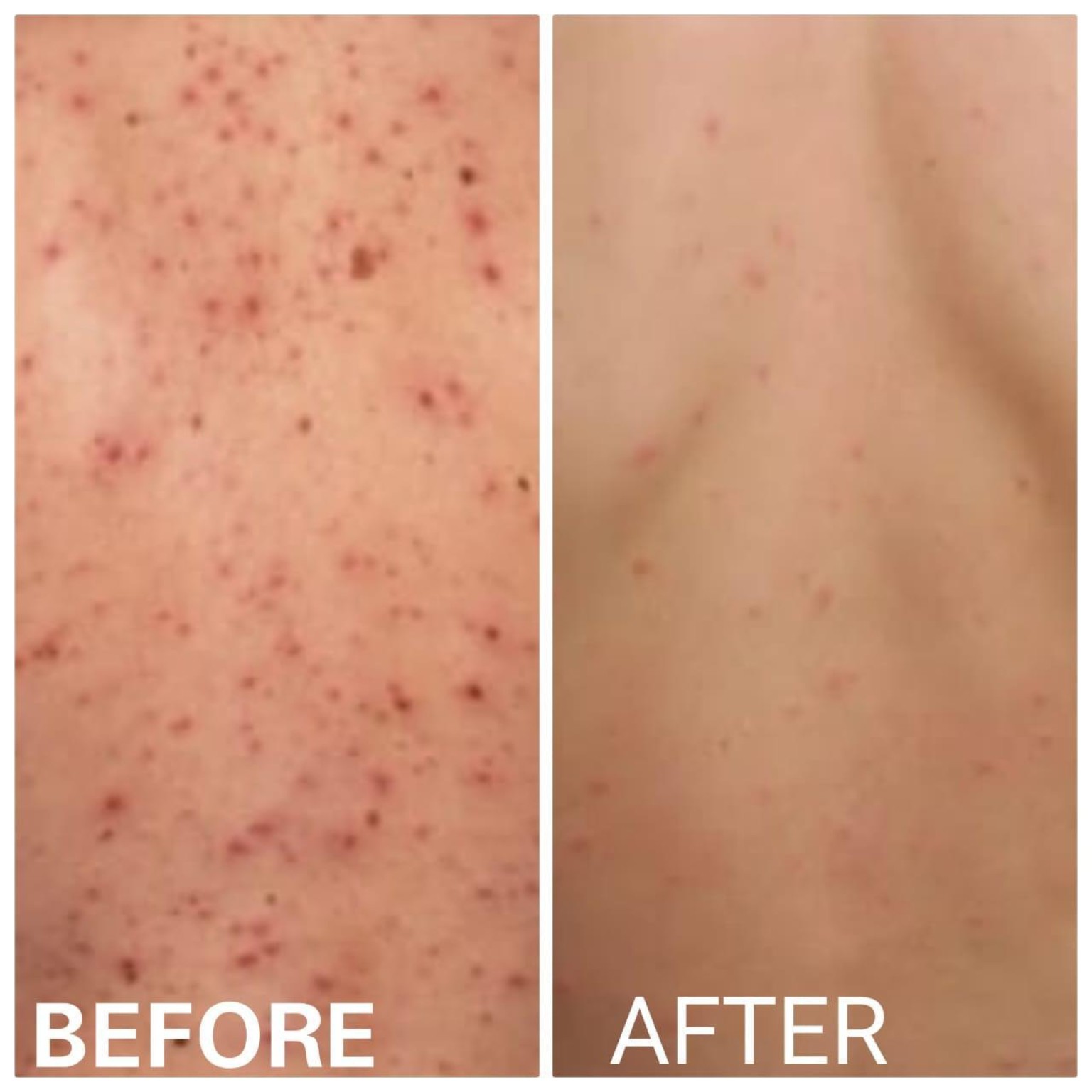 Skin Allergy Treatment Clearance