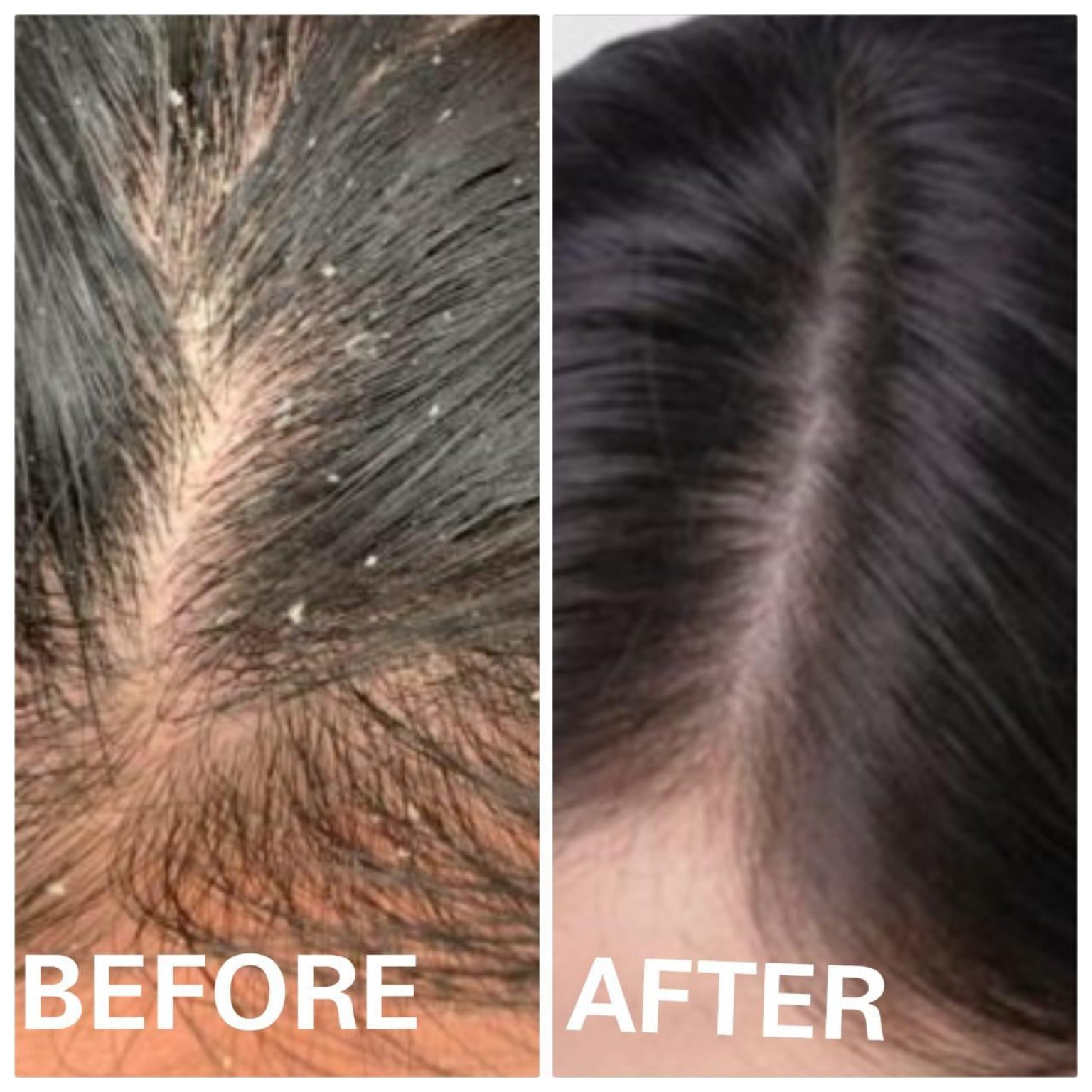 Complexion Correction and Overall Skin Glow